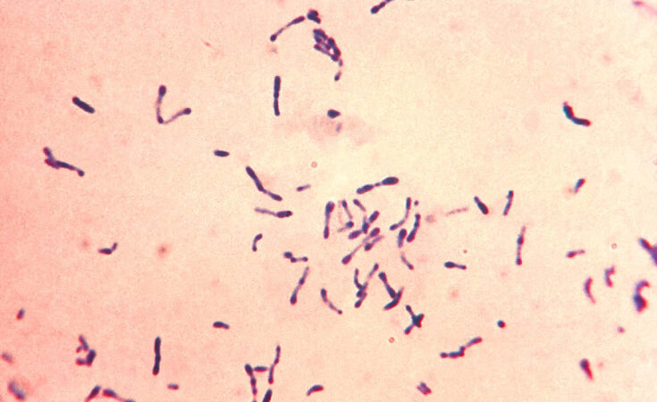 Foto: Public Health Image Library (PHIL)