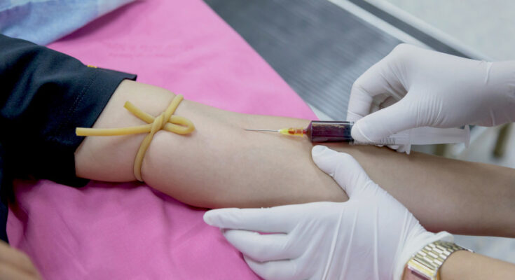 Foto: pexels.com/Amornthep Srina